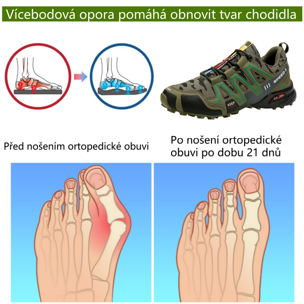 ⚡Omezený sleva 50 % - Ergonomické ortopedické boty - Pro úlevu od bolesti nohou, zad a kloubů - Unisex